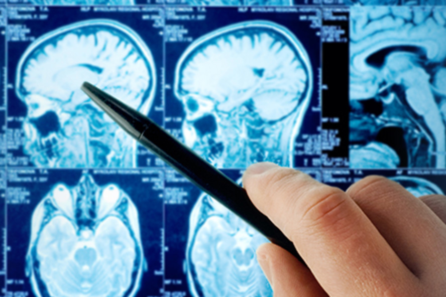 Course review: Brain imaging for rehabilitation clinicians